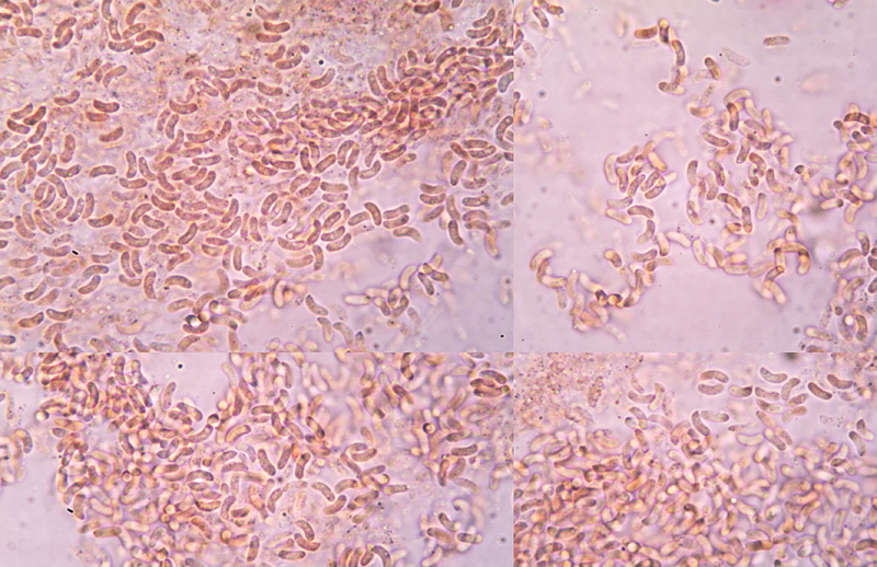 Piptoporus betulinus spory